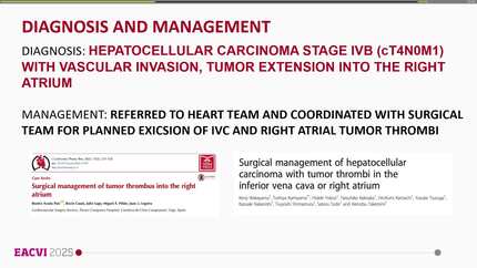 Hepatocellular carcinoma with intracardiac extension: a rare case of right atrial involvement