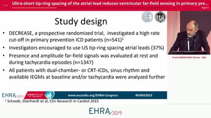 Ultra-short tip-ring spacing of the atrial lead reduces ventricular far-field sensing in primary prevention ICD recipients