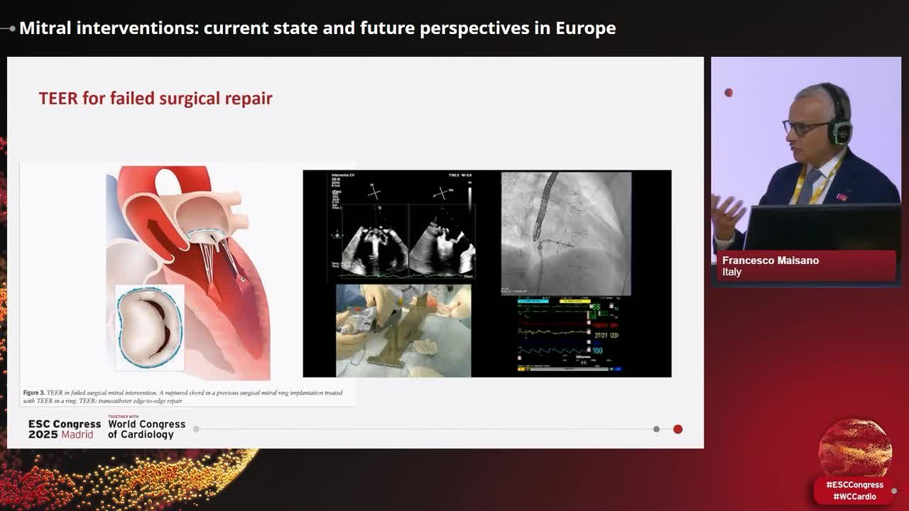 Mitral interventions: current state and future perspectives in Europe