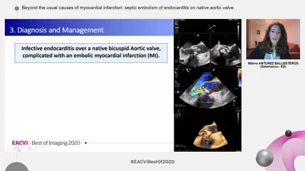 Presentation thumbnail