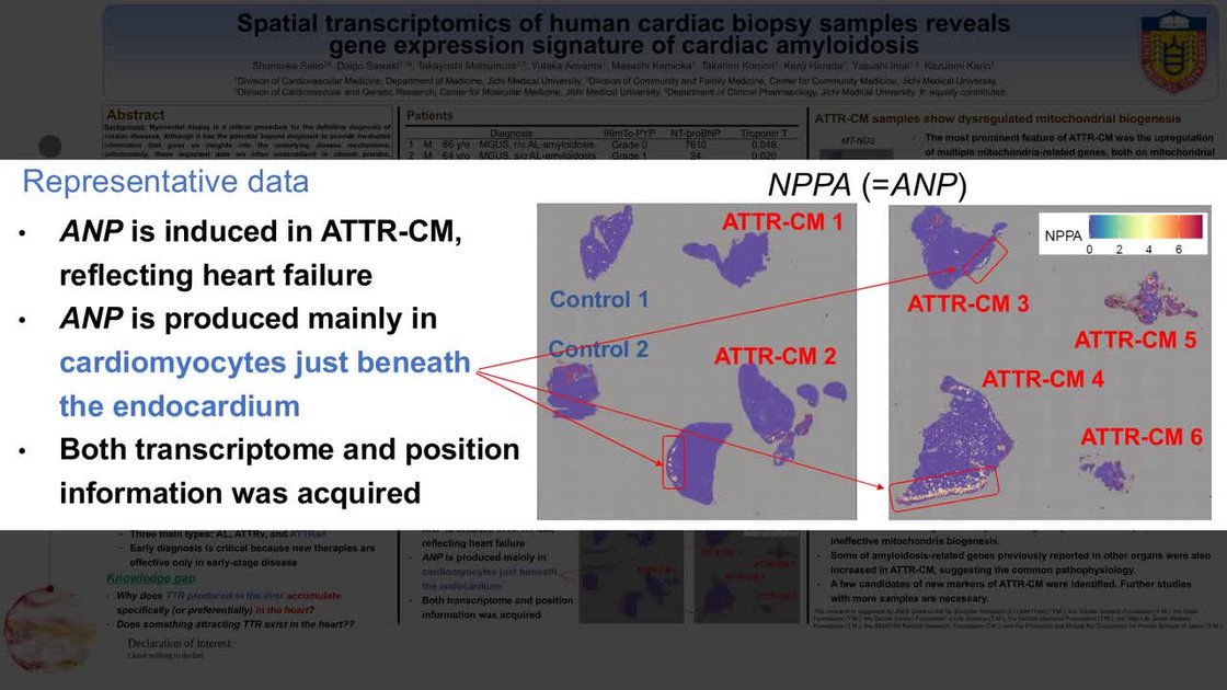 ESC 365 - Spatial transcriptomics of human cardiac biopsy samples ...