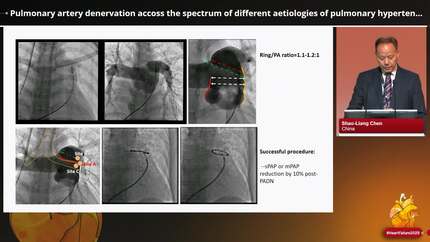 Emerging interventional procedures in heart failure and pulmonary hypertension