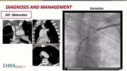 Presentation thumbnail