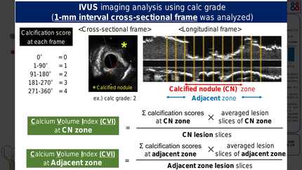 Implications of calcified nodule and adjacent calcification severity for target lesion revascularization after percutaneous coronary intervention: multi-center intravascular ultrasound imaging study