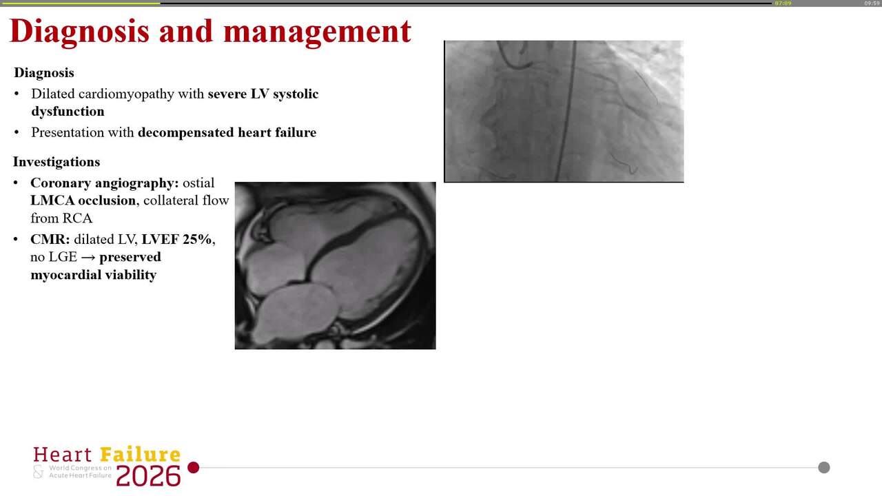A potentially reversible and unexpected cause of cardiac dysfunction following radiotherapy and chemotherapy in a patient with non-Hodgkin lymphoma