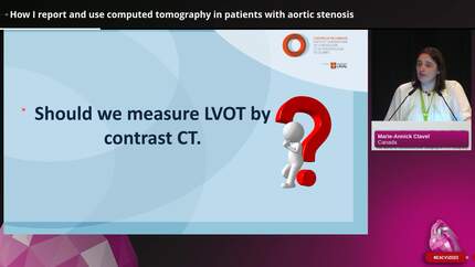 Tips and tricks from the experts for routine cardiac computed tomography