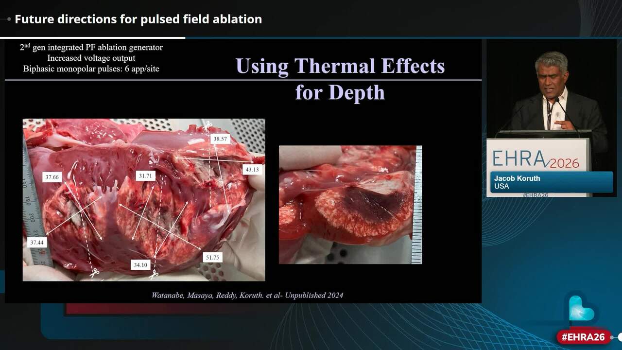 Pulsed field ablation in the future