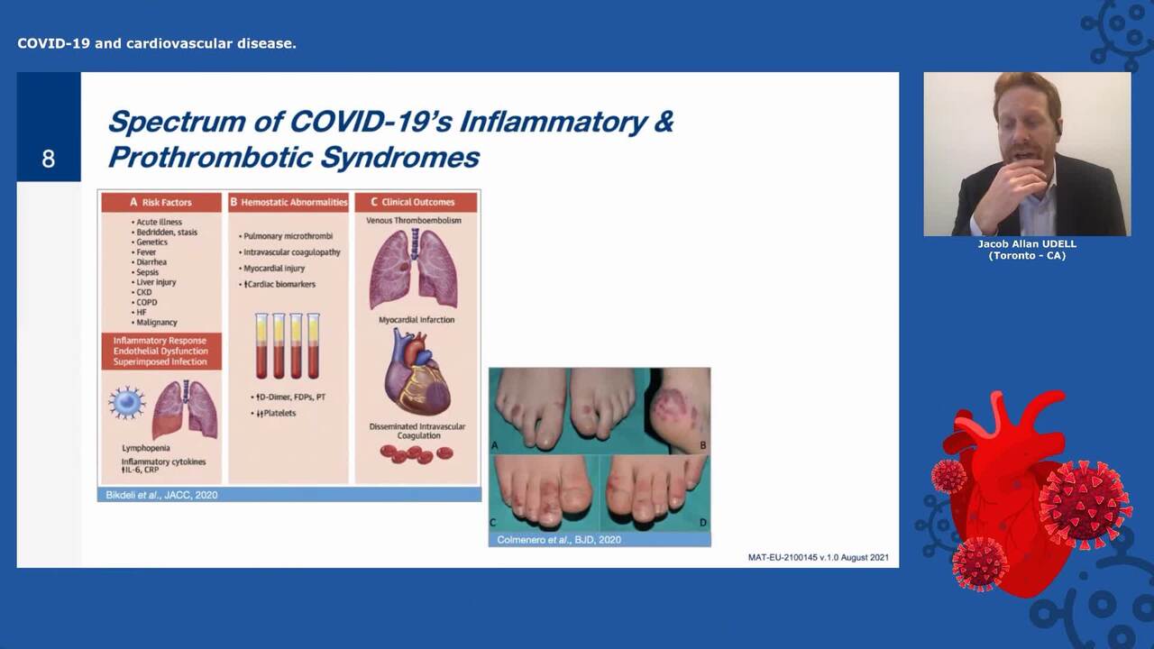 Influenza and cardiovascular outcomes: protection beyond flu during the time of Covid-19
