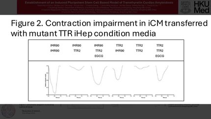 Establishment of an induced pluripotent stem cell based model of transthyretin cardiac amyloidosis