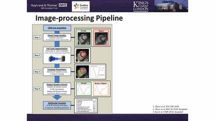 Fully automated assessment of filling and ejection rates of the ventricle. Reference values for healthy volunteers from the UK-biobank cohort.