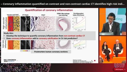 From pixels to prognosis: imaging, artificial intelligence, and the future of coronary artery disease diagnosis