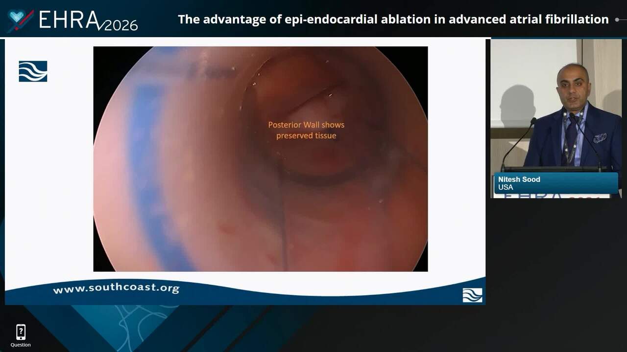 The advantage of epi-endocardial ablation in advanced atrial fibrillation