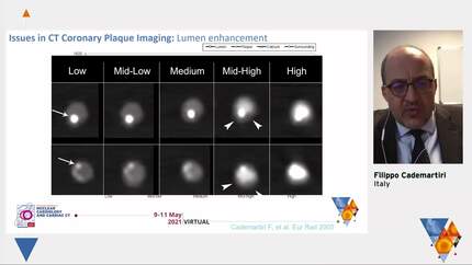 Presentation thumbnail