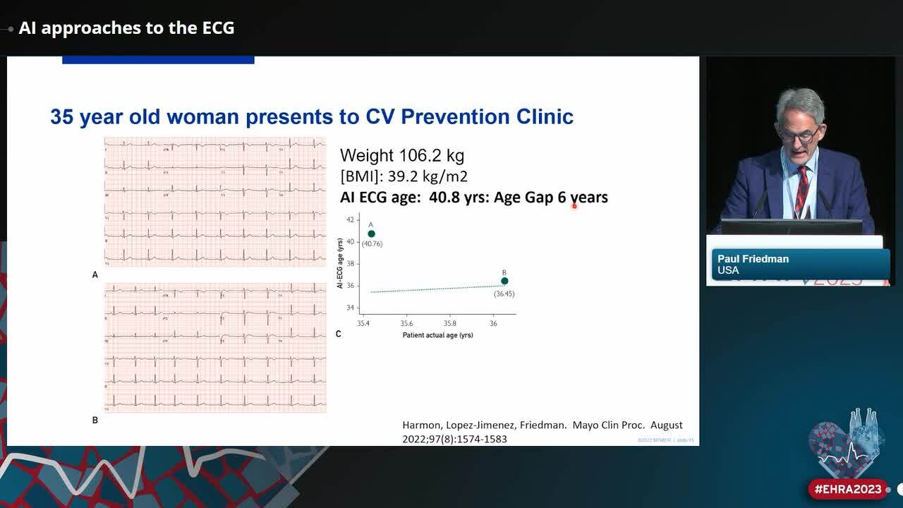 AI approaches to the ECG
