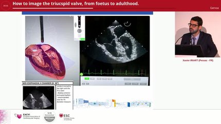 Presentation thumbnail