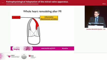 Pathophysiological Adaptation of the mitral valve apparatus.