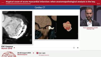 Presentation thumbnail