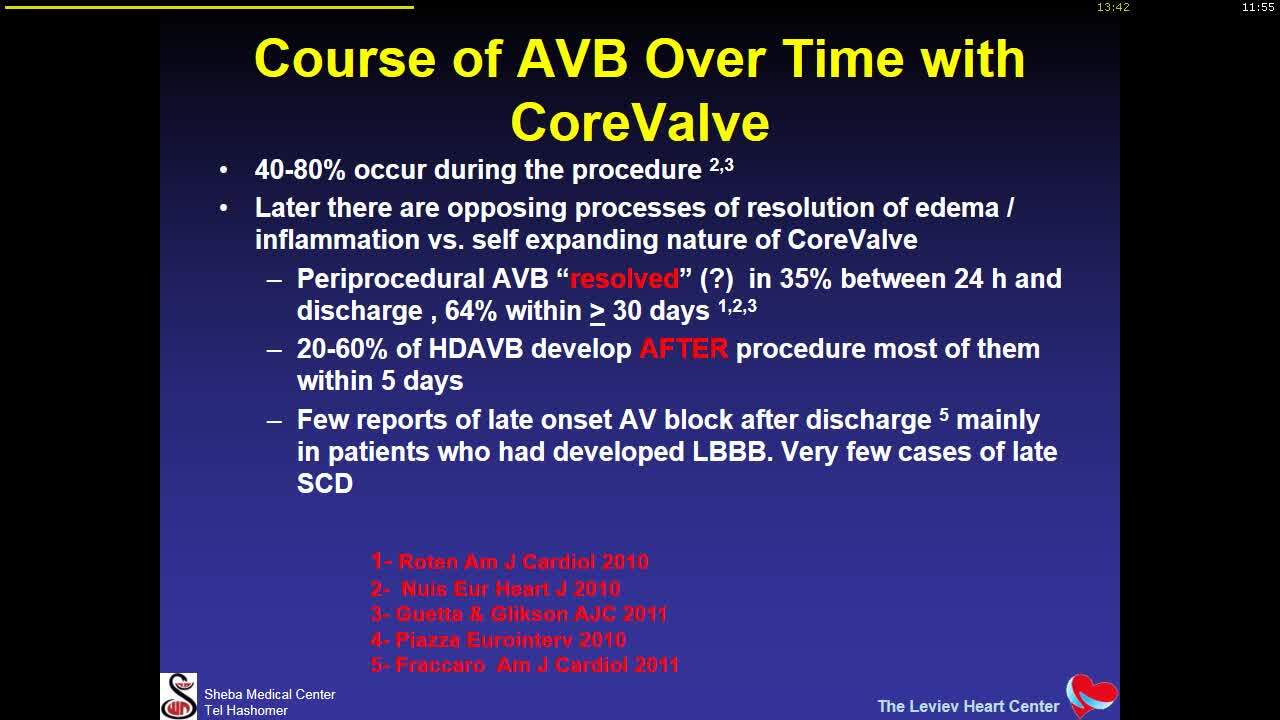 Conduction disturbances after TAVI - how to monitor and when to implant a permanent pacemaker.