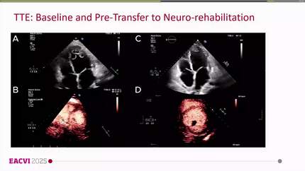 Presentation thumbnail