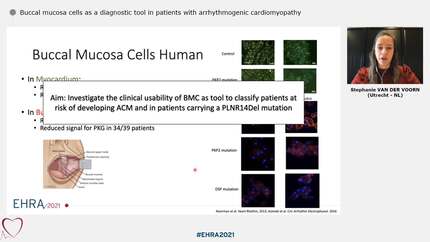 Buccal mucosa cells as a diagnostic tool in patients with arrhythmogenic cardiomyopathy