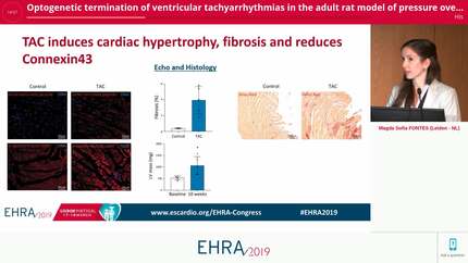 Optogenetic termination of ventricular tachyarrhythmias in the adult rat model of pressure overload