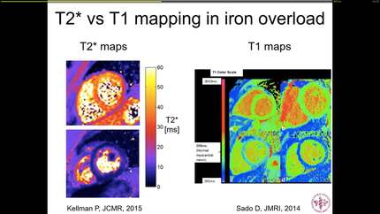 Parametring mapping and clinical applications.