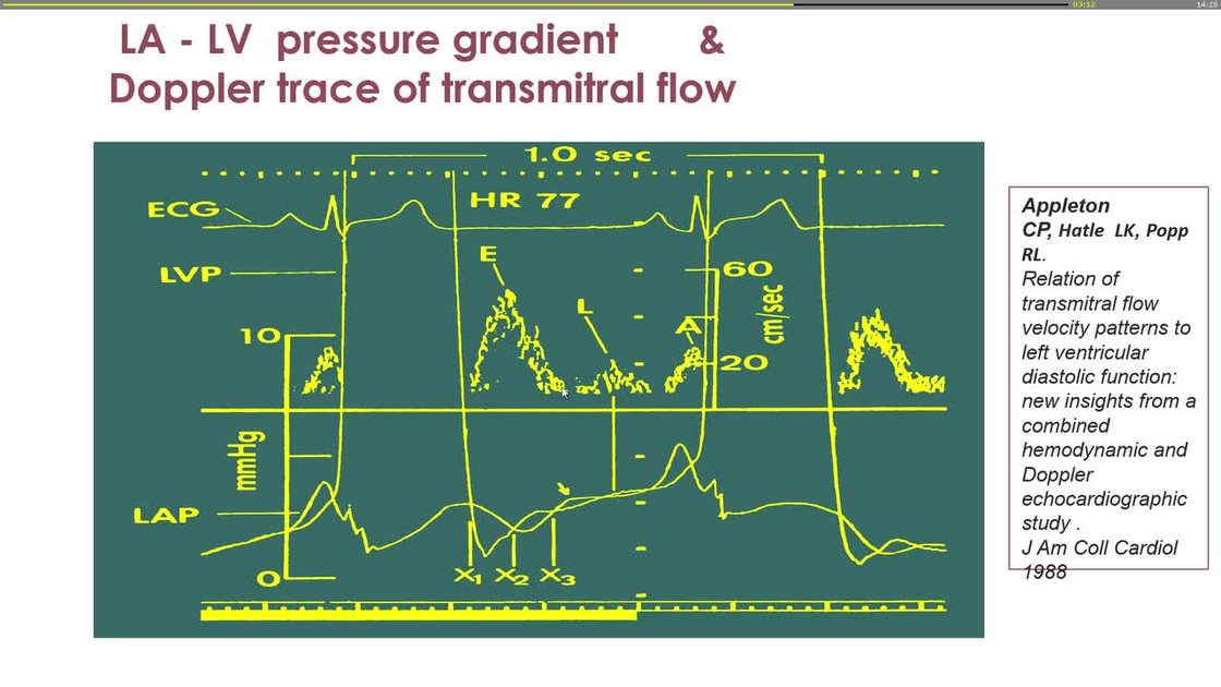 ESC 365 - Diastolic function and left atrial pressures