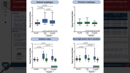 Evaluation of esophageal injury after very high-power short-duration pulmonary vein isolation using late gadolinium enhancement MRI 