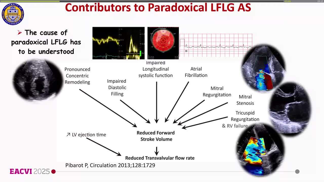 Challenging valvular heart diseases: a task for the fantastic four!