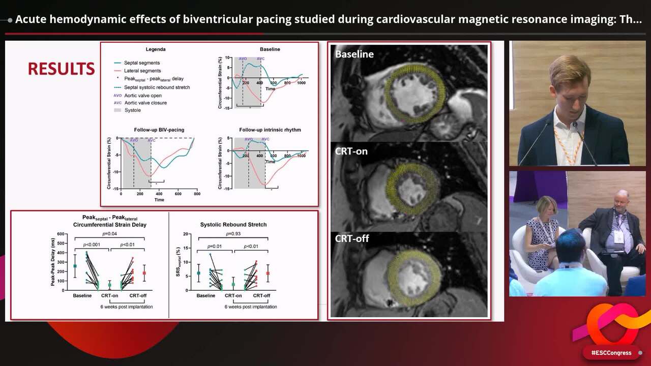 Acute hemodynamic effects of biventricular pacing studied during cardiovascular magnetic resonance imaging: The PICARIA Trial
