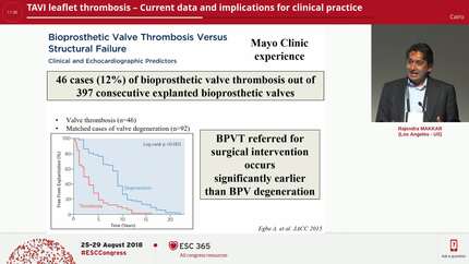 TAVI leaflet thrombosis – Current data and implications for clinical practice 