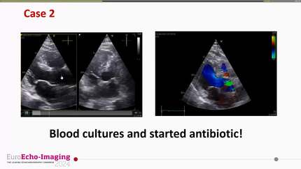 Presentation thumbnail