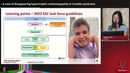 A case of disappearing hypertrophic cardiomyopathy in Costello syndrome