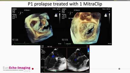 Presentation thumbnail