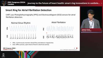 Journey to the future of heart health: smart ring innovations in cardiology