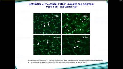 The antiarrhythmic effects of melatonin in different pathological conditions