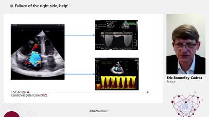 Presentation thumbnail