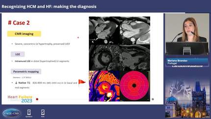 Hypertrophic cardiomyopathy and heart failure: exploring new options