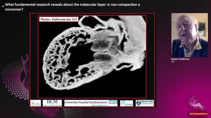 What fundamental research reveals about the trabecular layer: is non-compaction a misnomer?
