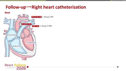 Presentation thumbnail