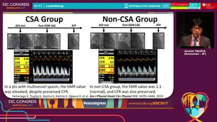 Evaluating the coronary microcirculation.