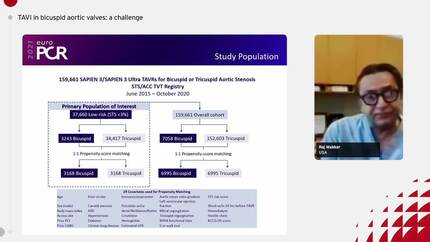 Outcomes after TAVI in bicuspid aortic valves.
