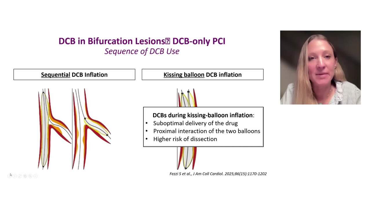 The role of drug-coated balloons in contemporary PCI
