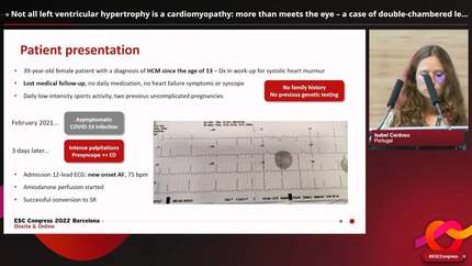 Adult congenital heart disease 