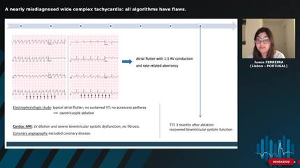 A nearly misdiagnosed wide complex tachycardia: all algorithms have flaws.