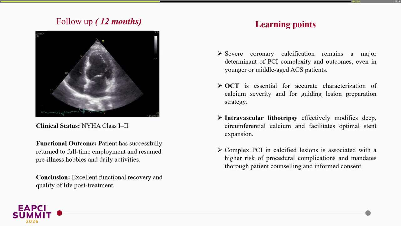 Cracking the challenge: two-stage pci with initial flow rescue and subsequent IVL-guided calcium modification