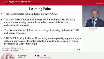 CT myocardial perfusion.