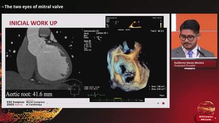 The two eyes of mitral valve