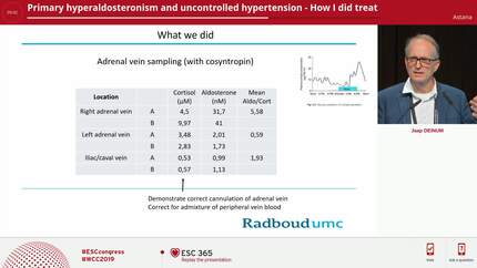 Primary hyperaldosteronism and uncontrolled hypertension - How I did treat