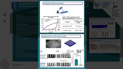 Development of a flexible conductive microneedle-based sensor for non-invasive monitoring of jugular venous pressure in heart failure patients